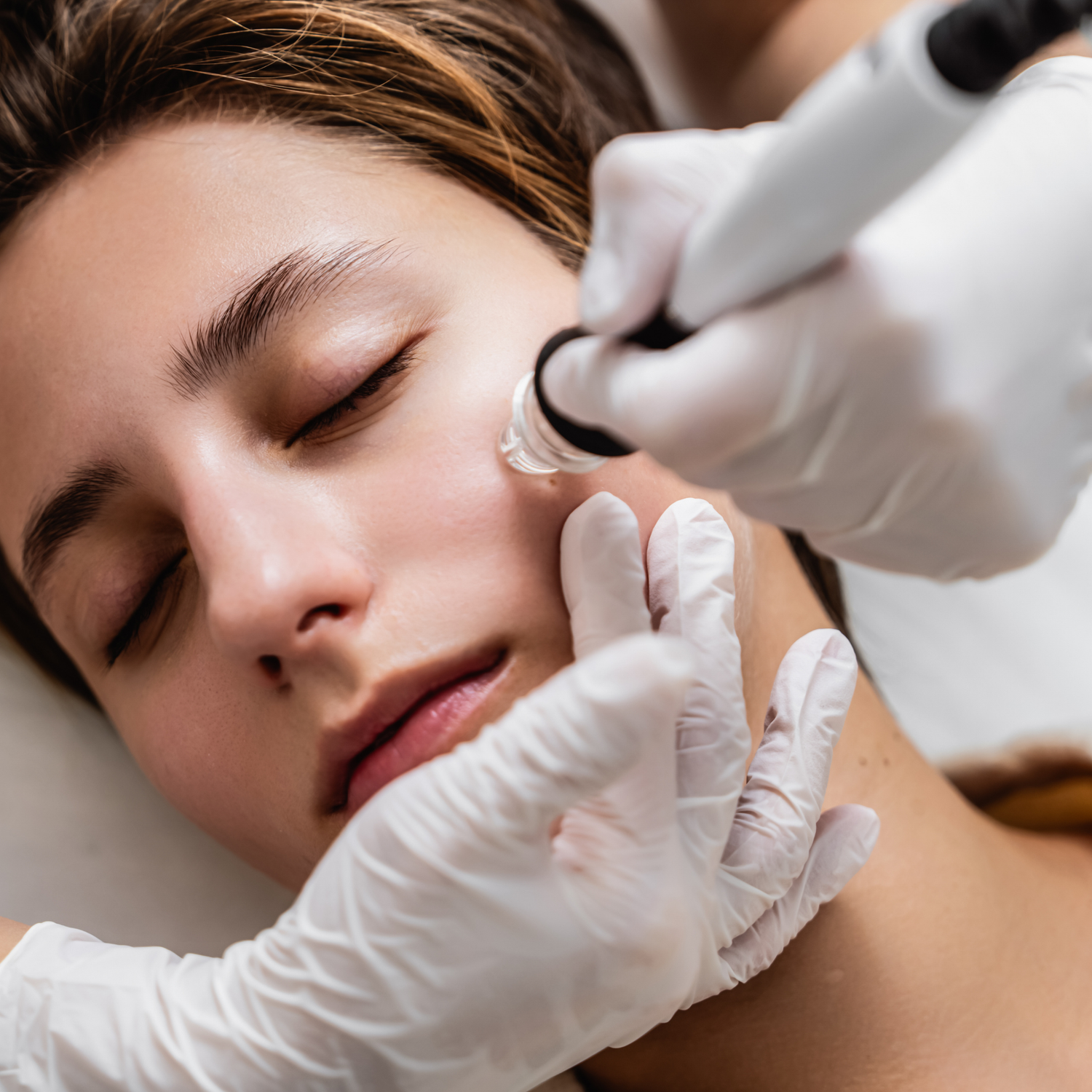 Beauty-bar-winterhude-hydrafacial-extraktion